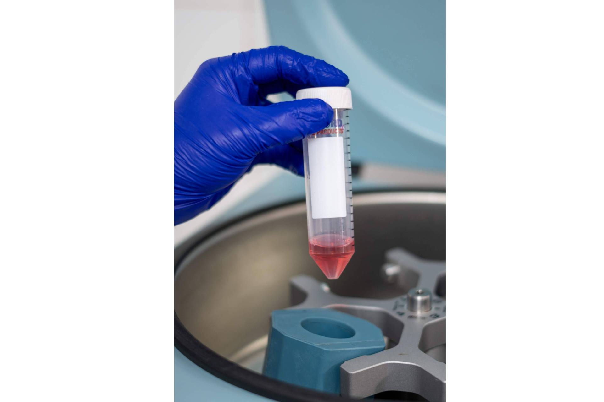 Cancer avanzado; El valioso aporte actual de la inmunoterapia DEX en el tratamiento personalizado del cáncer